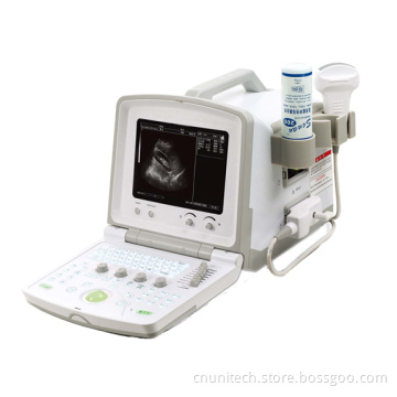 Portable Digital Ultrasound Scanner (UNT-380)